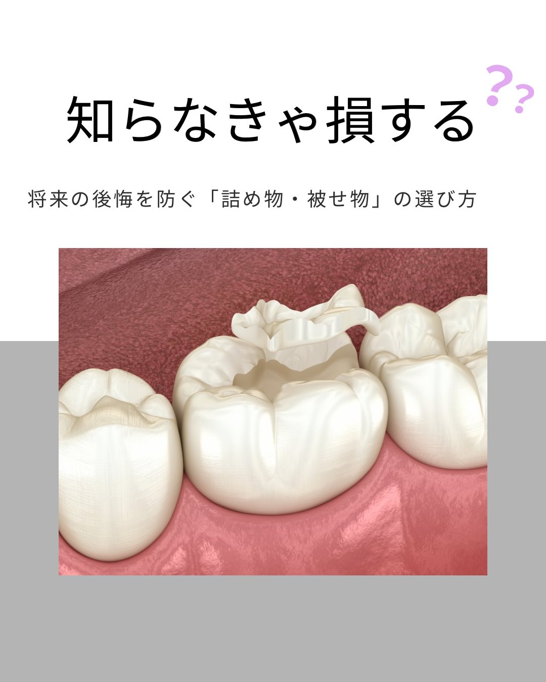 こんにちは奥田歯科医院です🦷