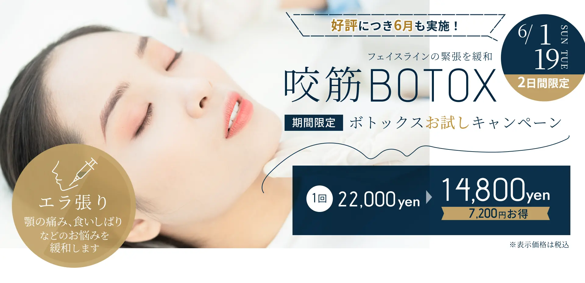 期間限定ボトックス キャンペーン