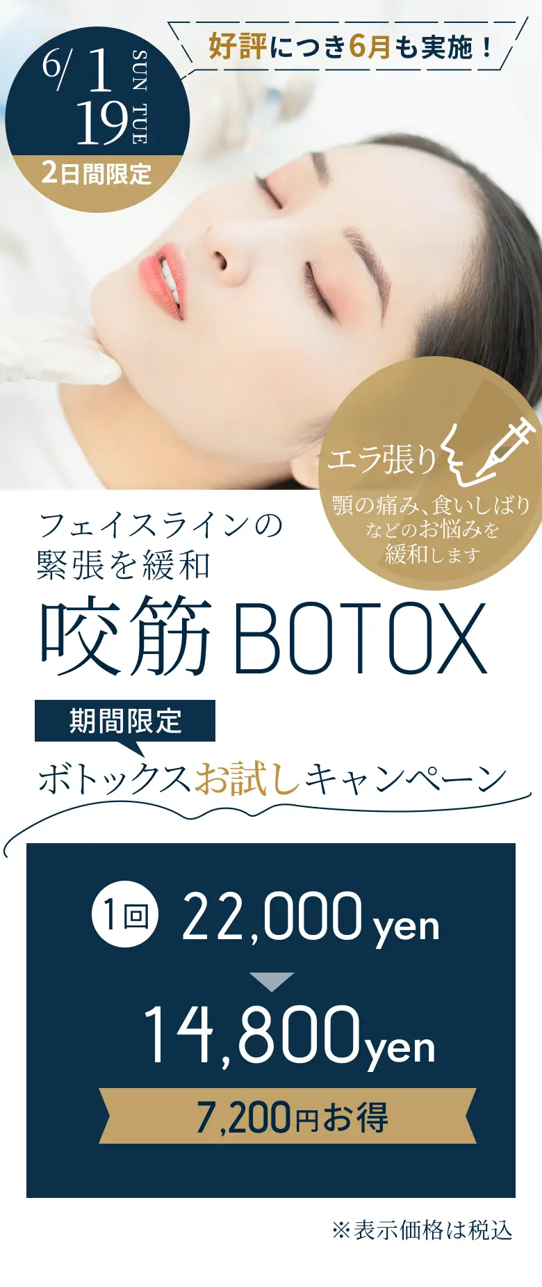 期間限定ボトックス キャンペーン