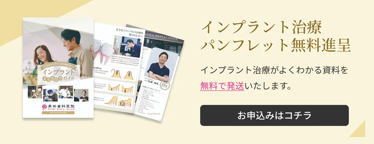 インプラント治療パンフレット無料進呈